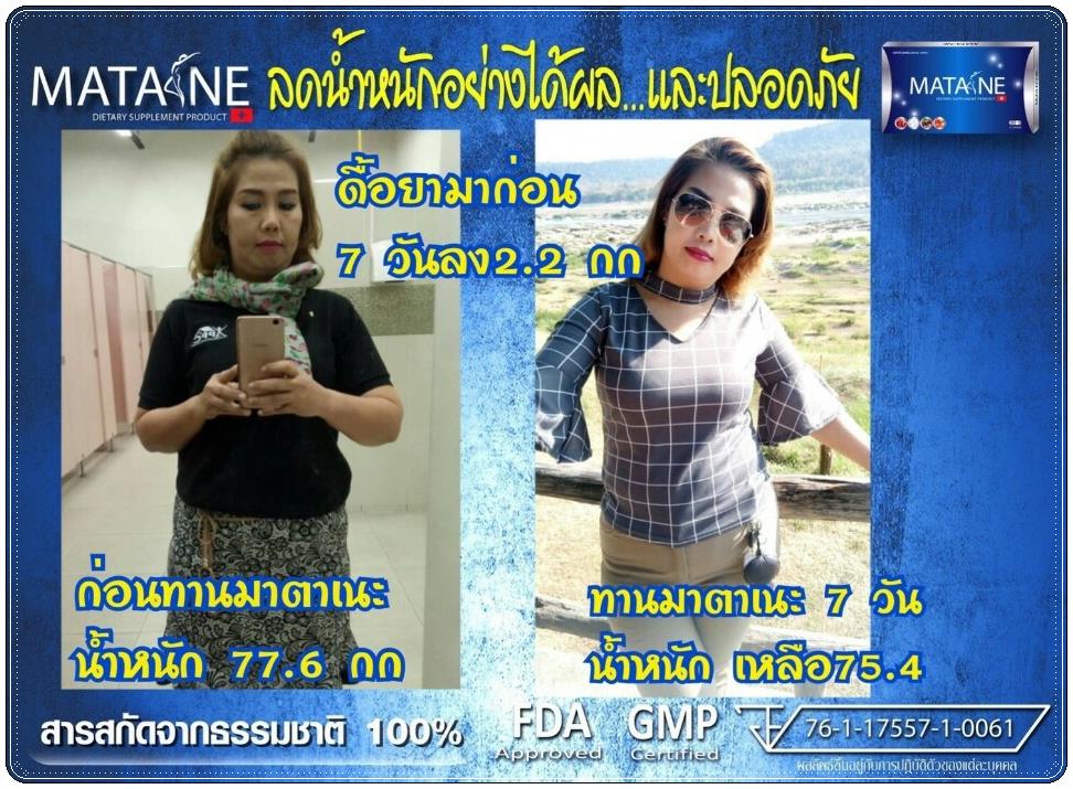 มาตาเนะ MATANE ตัวช่วยในการลดน้ำหนัก อย่ามัวแต่มองไม่ผอมนะจ๊ะ
