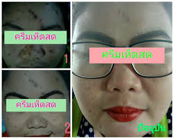 ครีมเห็ดสดHiyady