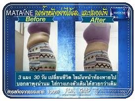 มาตาเนะ MATANE ตัวช่วยในการลดน้ำหนัก อย่ามัวแต่มองไม่ผอมนะจ๊ะ