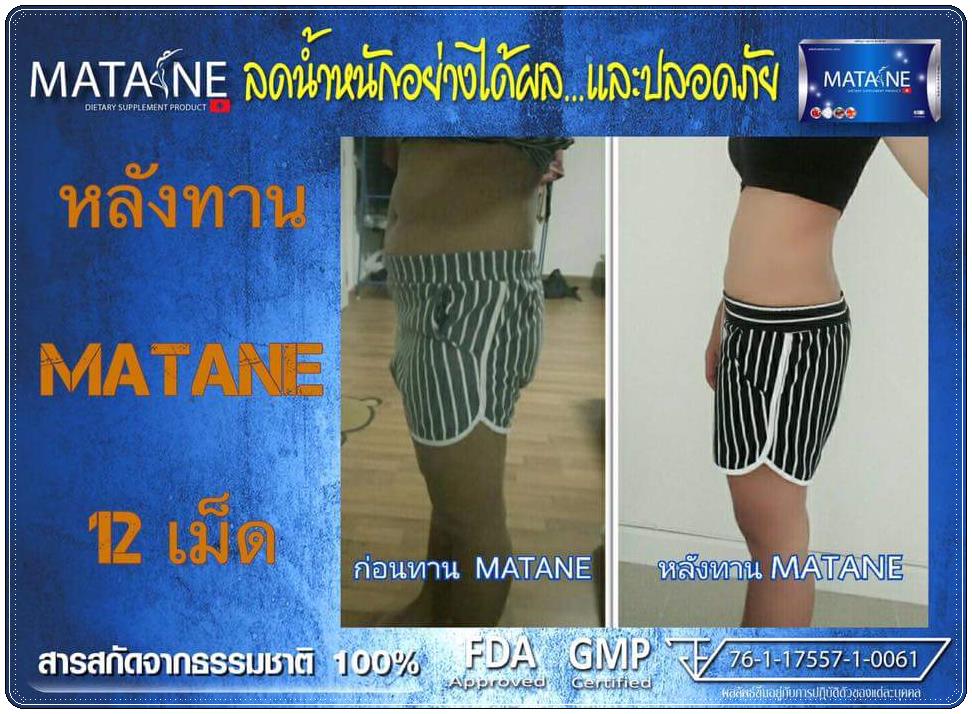 มาตาเนะ MATANE ตัวช่วยในการลดน้ำหนัก อย่ามัวแต่มองไม่ผอมนะจ๊ะ