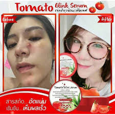 Tomato Blink Serum เจลมะเขือเทศ