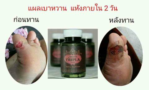 อัมรันต์ ตรีผลา สมุนไพรต้านมะเร็ง รักษาภูมิแพ้ ด้วยเทคโนโลยีการสกัดที่ทันสมัย