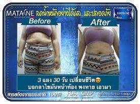 มาตาเนะ MATANE ตัวช่วยในการลดน้ำหนัก อย่ามัวแต่มองไม่ผอมนะจ๊ะ