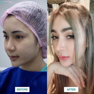 ดูดไขมัน โทร 095-5266242 เสริมหน้าอก เสริมจมูก ทำตา2ชั้น สำหรับผู้หญิงเรา ต้องสวย เพราะความสวยจะเปลี่ยนชีวิต